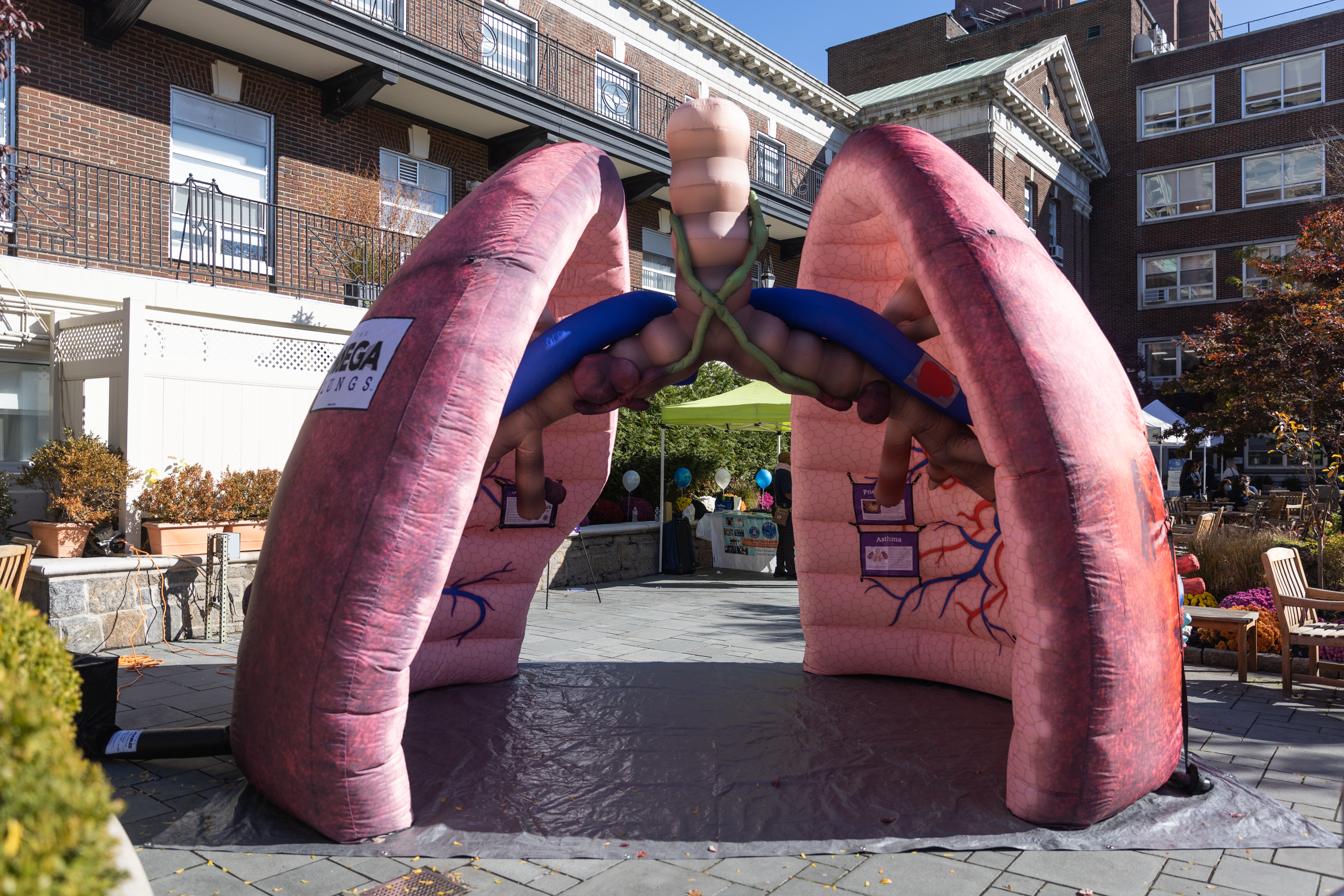 Giant inflatable lungs form an educational pavillion in the hospital courtyard.