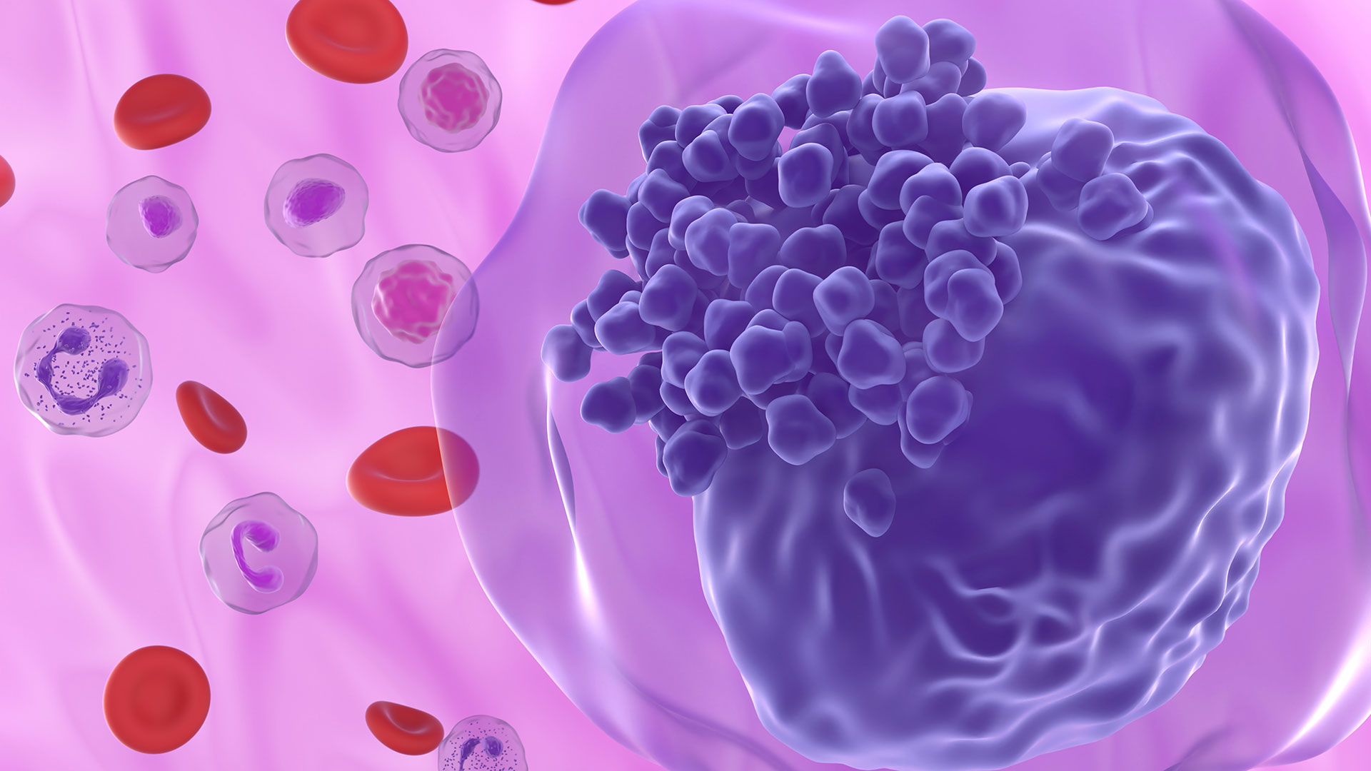 Promising New Therapy for a Hard-to-Treat Blood Cancer